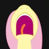 Fluttershy Screaming