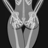 sexy xray